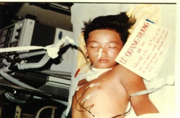 Hình.C.27: BN Lê Q.T, bị nhiễm độc nọc rắn Hổ đất giờ thứ 58 tại BV Chợ Rẫy, 1991