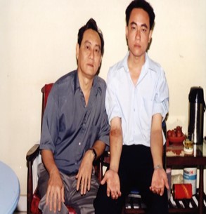 Hình.C.29: BN PQN bị nhiễm độc nọc rắn Hổ đất hồi phục bằng HTKN Hổ đất tại BV Chợ Rẫy, 1998.